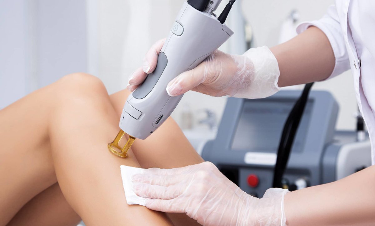 epilation-laser